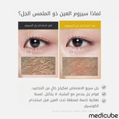 سيروم جل العين بفيتامينات الكركم وحمض الكوجيك 30 مل