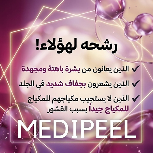 كريم إيزي فيلر