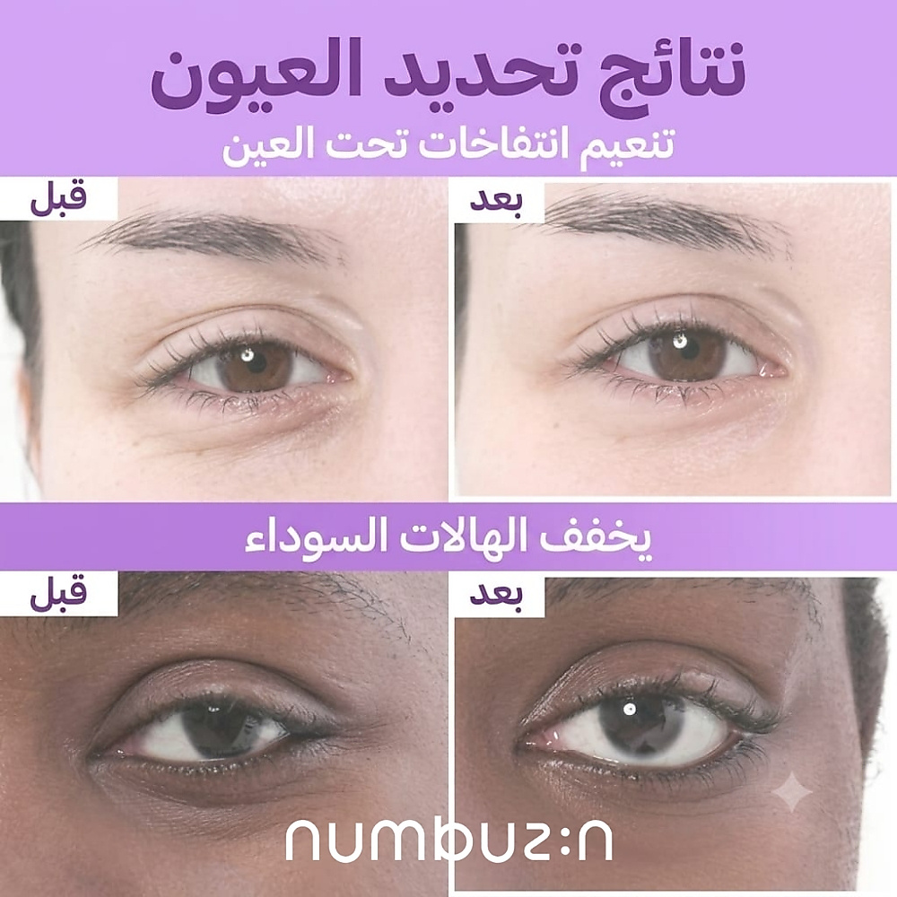 رقم 9 NAD لاصقات تحت العين (5 قطع)