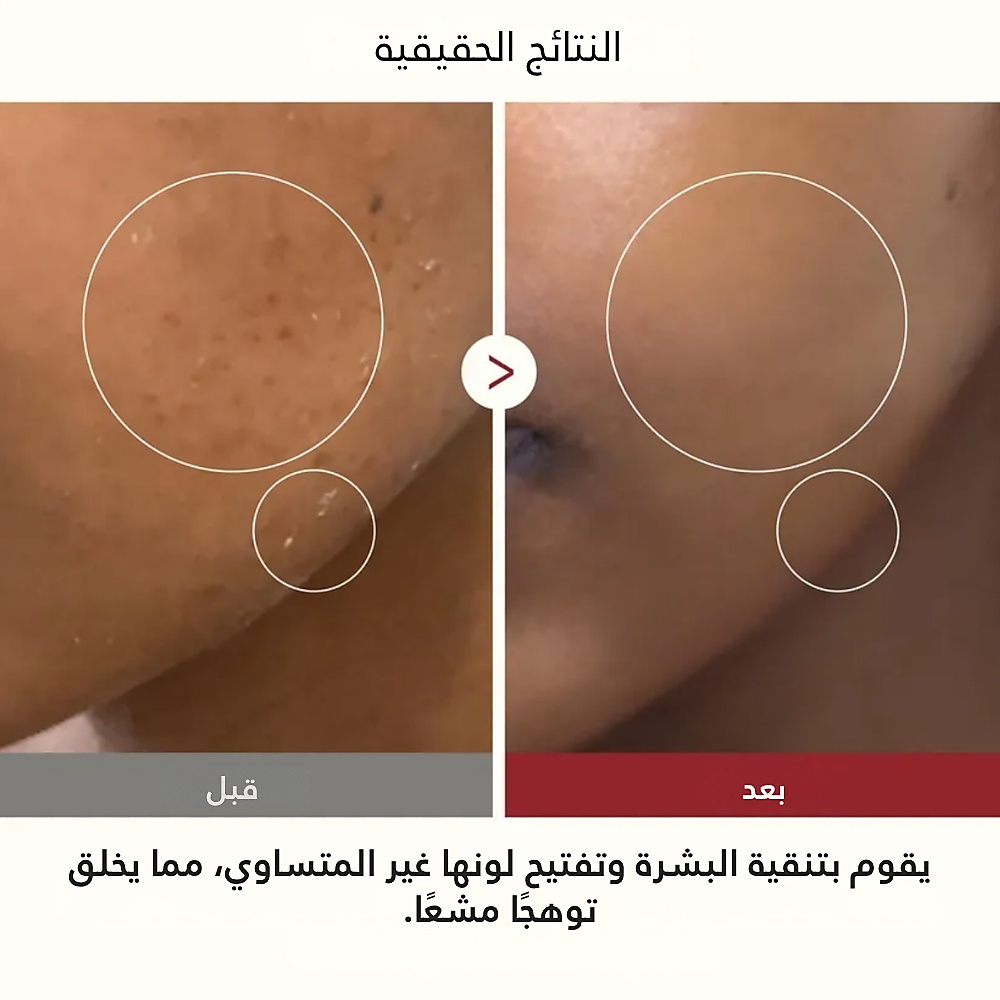 تونر الأرز الأبيض المتوهج بيل شوت 200 مل