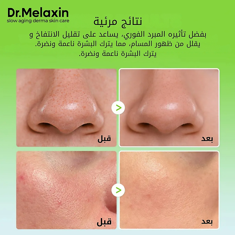 Cactox Pore Relief Multi Balm 25g