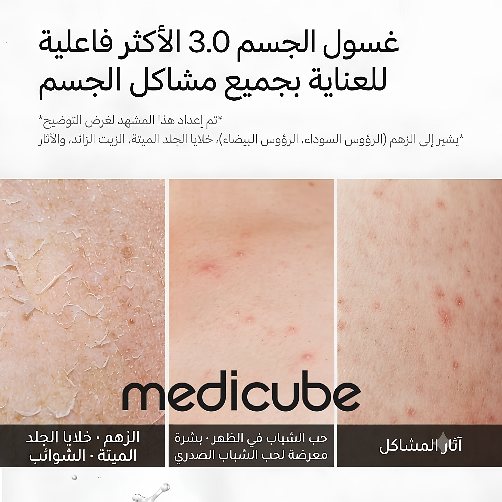 غسول الجسم "ريد" (Red) لعلاج حب الشباب 2.0 - 400 مل (إصدار مُجدَّد)