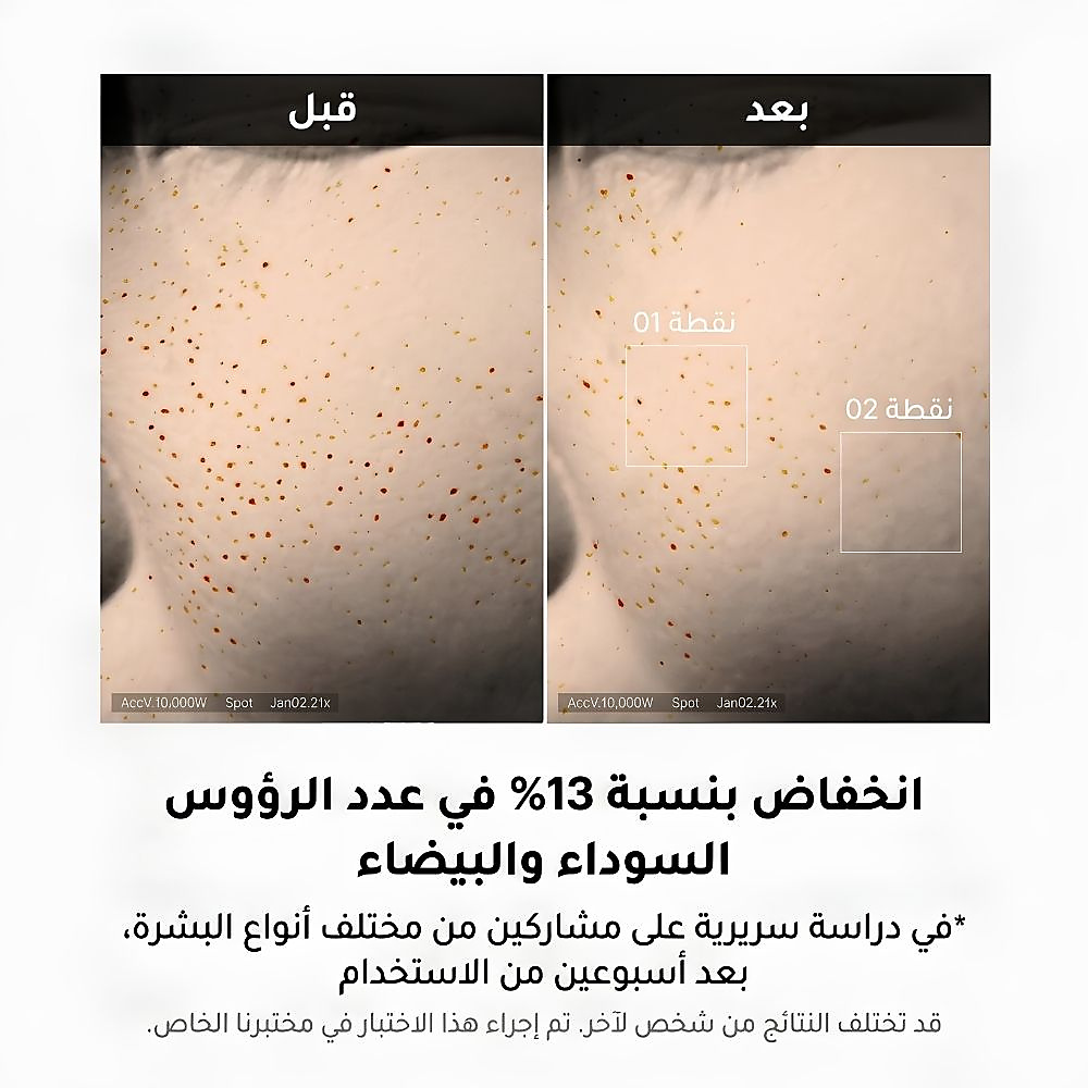 Zero Pore One Day Serum 30ml