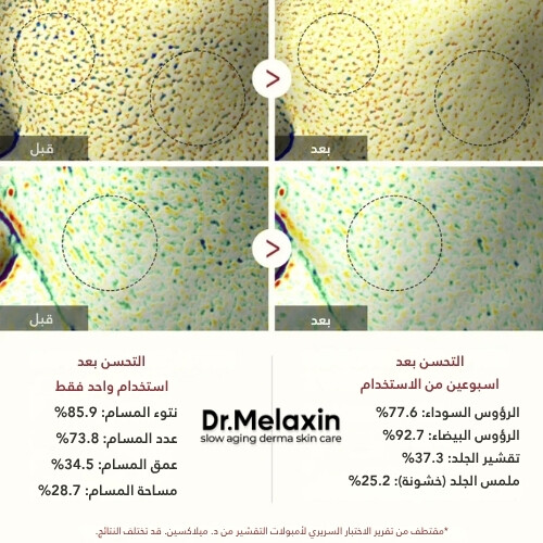 أمبولة تقشير  بالأرز الأبيض ٨٠ مل