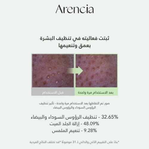منظف ​​موتشي الأرز الأخضر الطازج الجديد 120 جرام