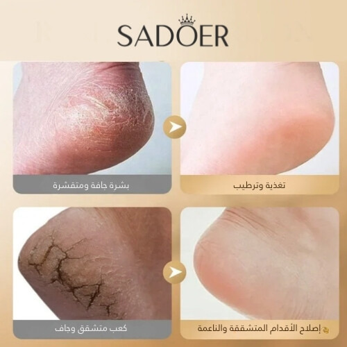 كريم سادور للقدمين المغذي بالكولاجين المضاد للجفاف والتشقق - 60 جم