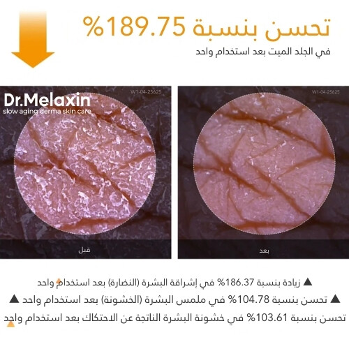 بخاخ التقشير بحمض الكوجيك والكركم من بيل شوت