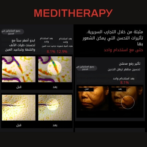 كريم شوماج جولد سيل لشد البشرة + جهاز شوماج للتحفيز الكهربائي للعضلات