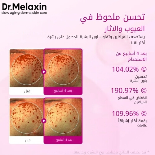 أمبولات سيمينريت بيكوتونيك شوت 30 مل