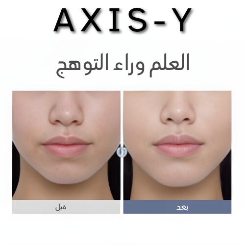 كريم تفتيح مكثف يحتوي على 2.5% من حمض الترانيكساميك (TXA) 50 مل