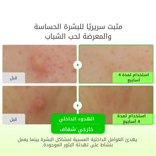 تونر مهدئ بخلاصة الصبار 150 مل