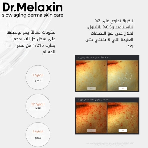أمبولة إصلاح الإكسوسوم بلس