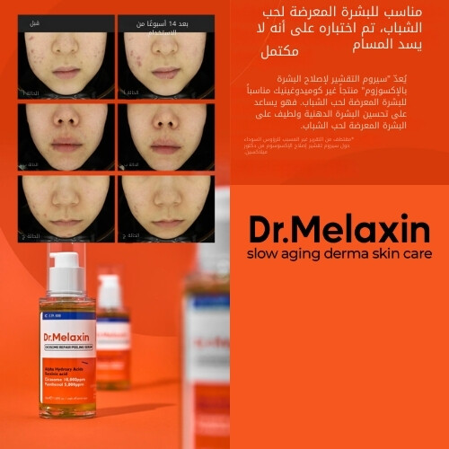 سيروم تقشير وإصلاح الإكسوسوم 50 مل