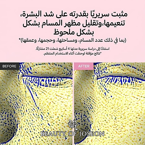 سيروم شد المسام بخلاصة الفاصوليا الحمراء PDRN+ ببتيد 30 مل