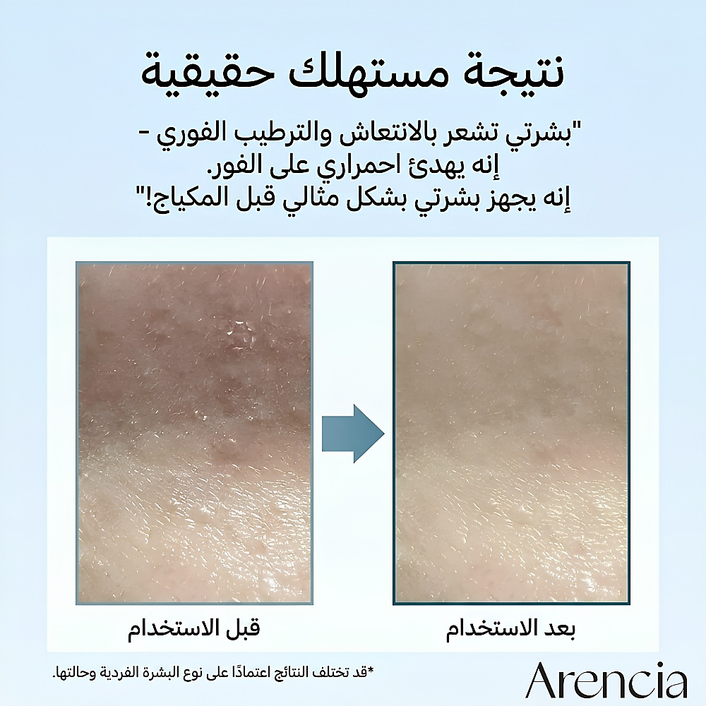 وسادة ترطيب عميق PDRN + حمض الهيالورونيك (90 قطعة)
