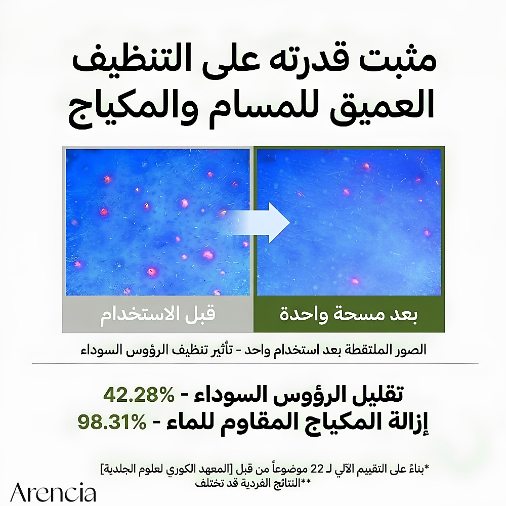 وسادة زيتية لتنظيف المسام (50 قطعة)