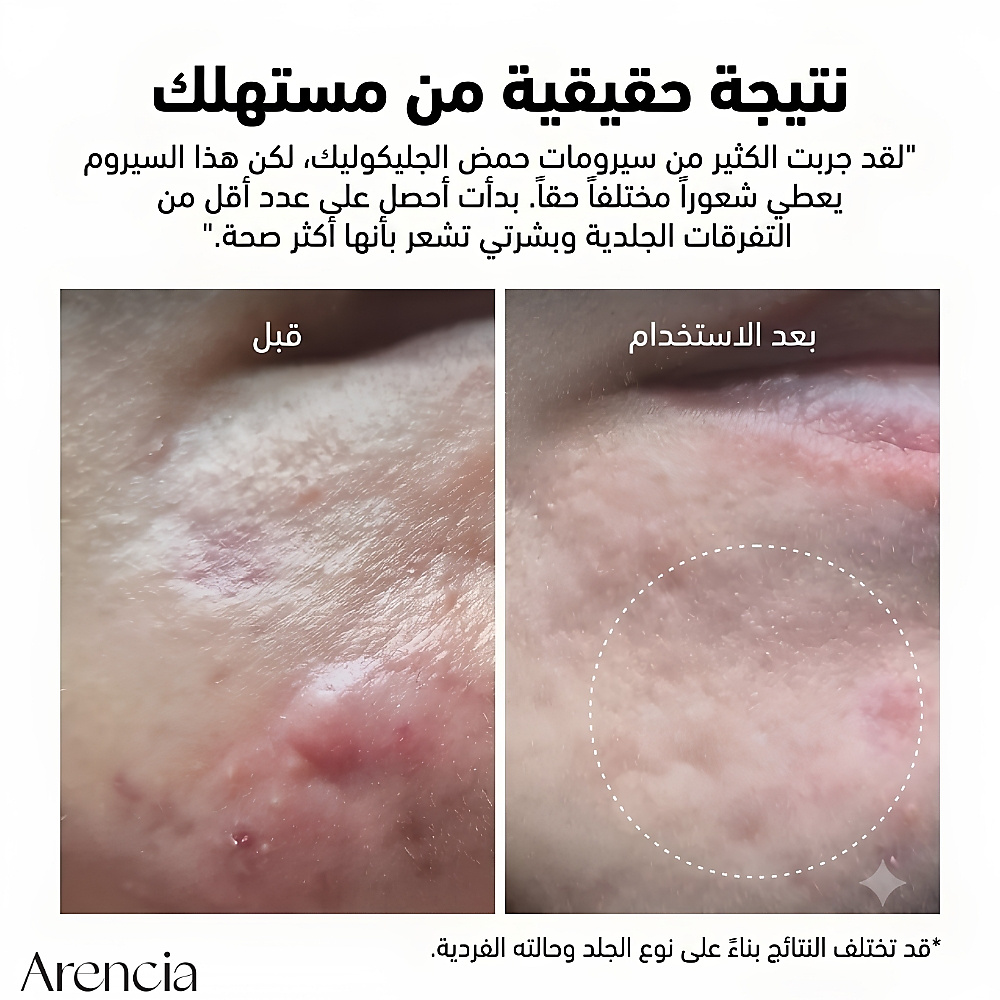 معزز حمض الجليكوليك من إريزر شوت 30 مل