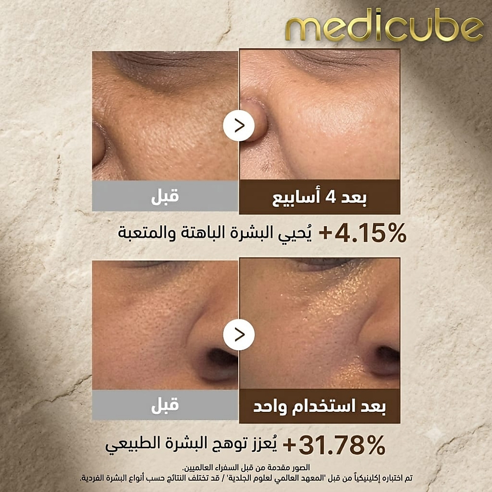 سيروم كبسولات فيتامين سي العميق 30 مل