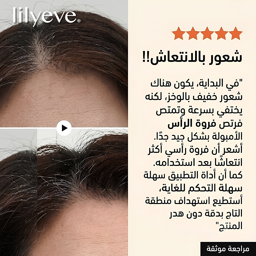 أمبولة إكسوسوم سبيكول من جرو: تيرن 3000 10 مل