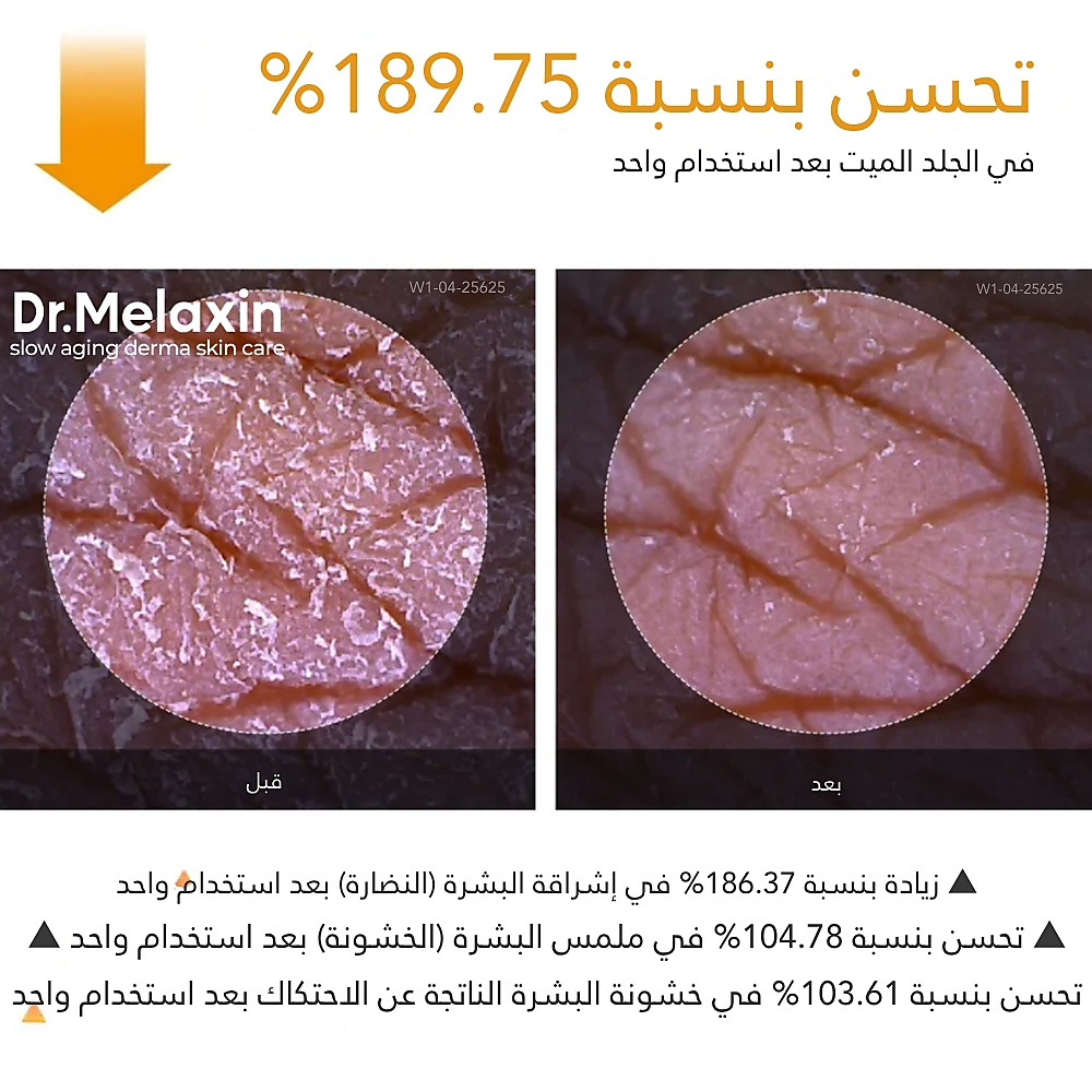 بخاخ التقشير بحمض الكوجيك والكركم من بيل شوت