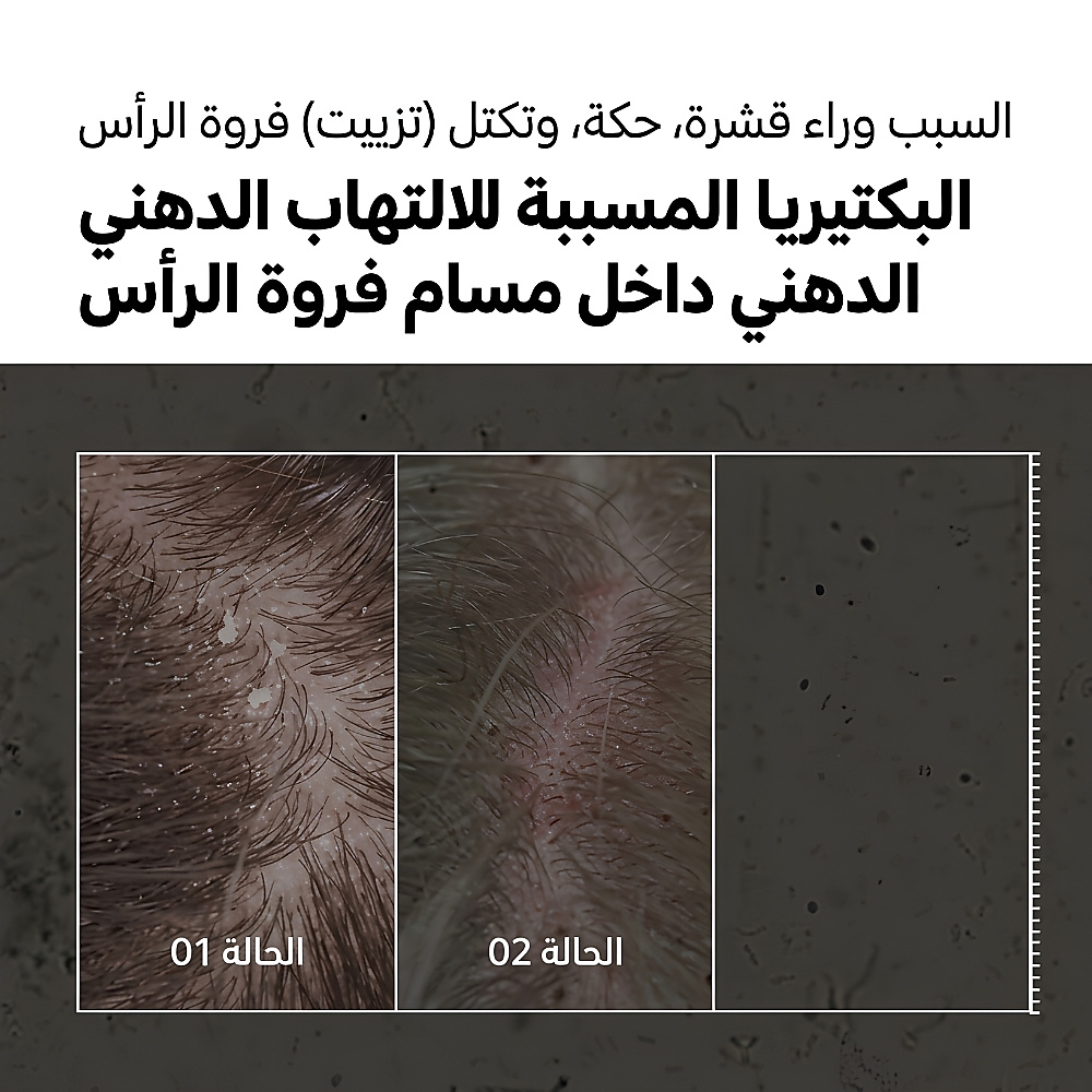 medicube Soymint Scaling Shampoo 490ml