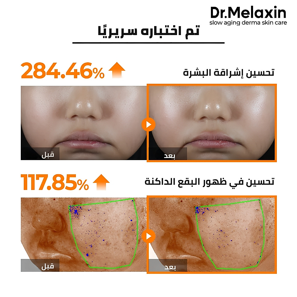Dr.Melaxin Mela CE Ferulic Serum 60ml