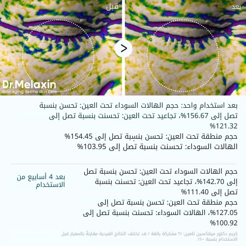 كريم إيفالت للهالات السوداء 10 غرام