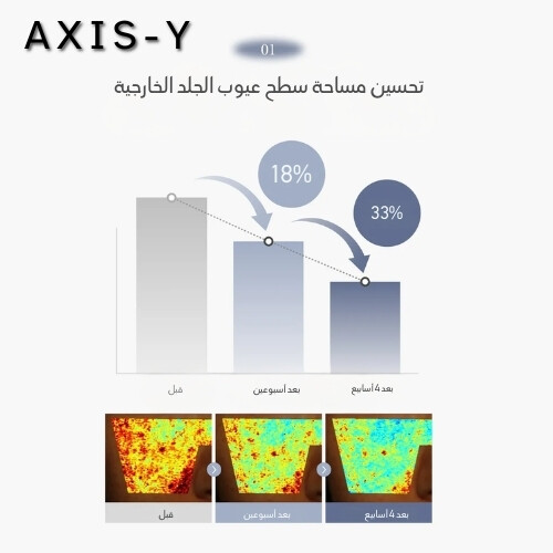 كريم تفتيح مكثف يحتوي على 2.5% من حمض الترانيكساميك (TXA) 50 مل