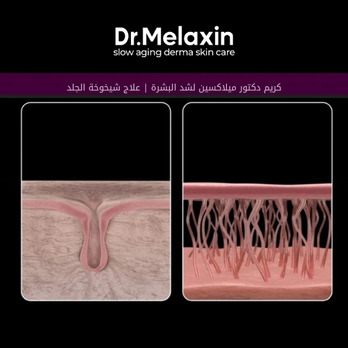 كريم شد البشرة من فيسفالت 50 غرام