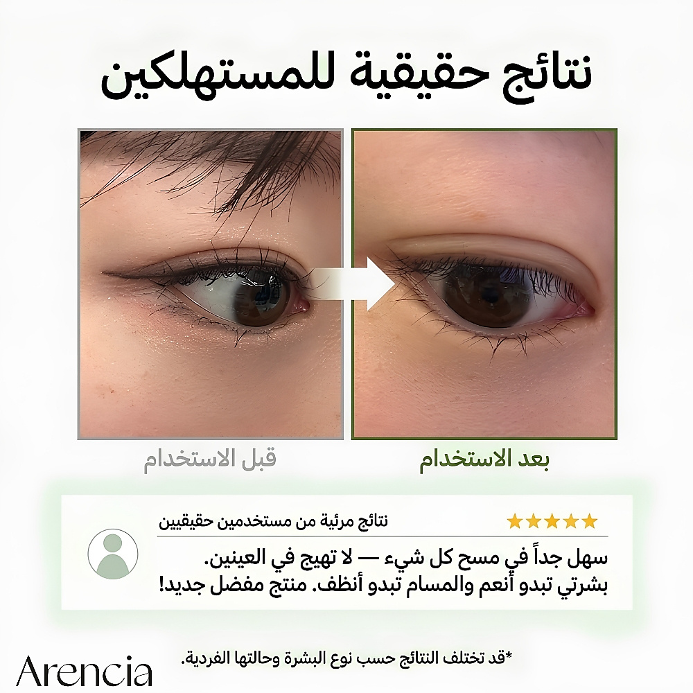 وسادة زيتية لتنظيف المسام (50 قطعة)