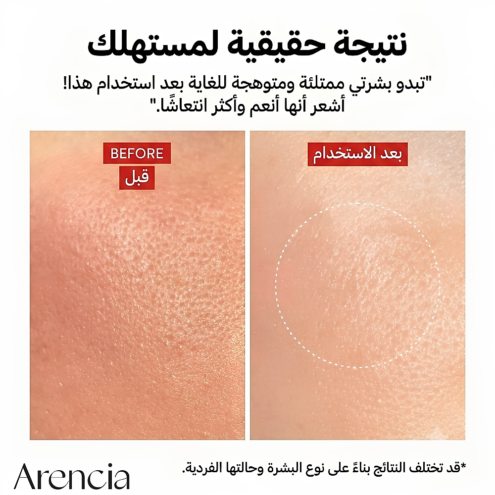 جرعة معززة من NAD+ 30 مل
