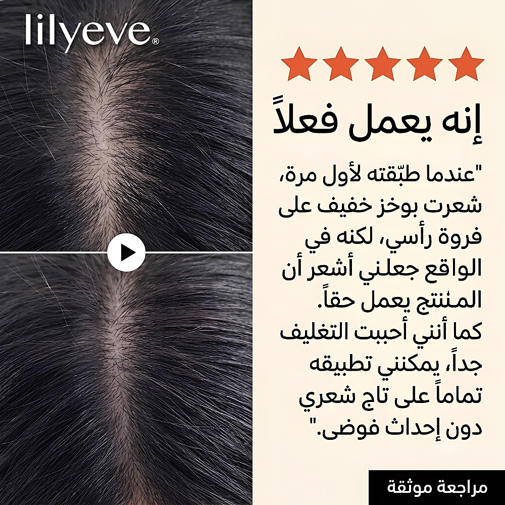 أمبولة إكسوسوم سبيكول من جرو: تيرن 3000 10 مل