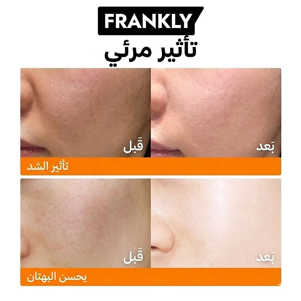 PDRN Bounce Ball Serum 30ml