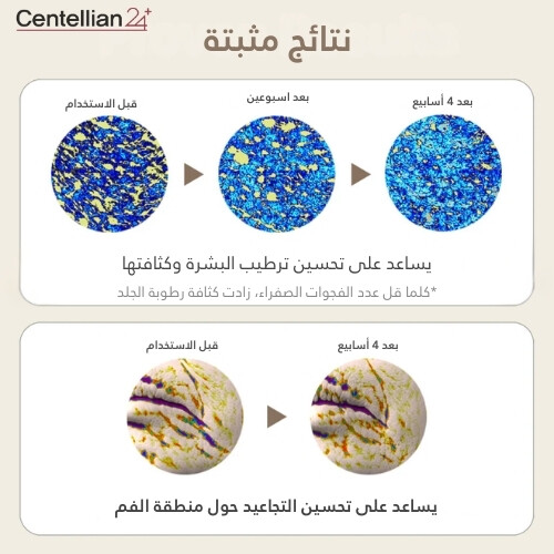ستك التقاط التجاعيد من ماديكا 10 g
