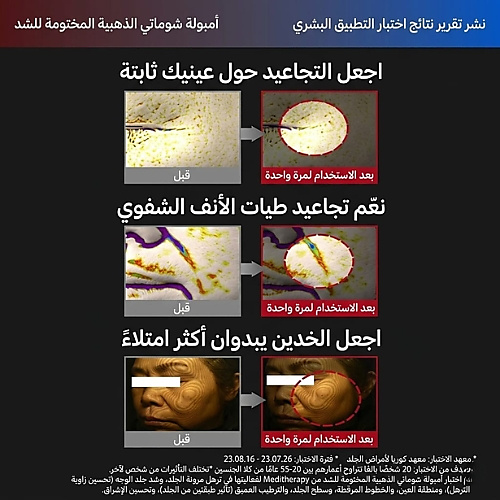 أمبولة شوماج شوت جولد سيل لشد البشرة 12 مل