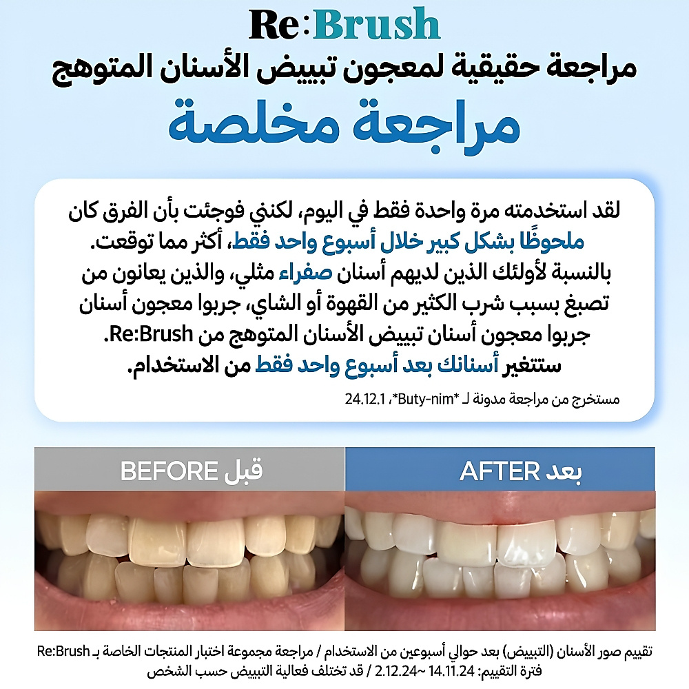 مجموعة معجون الأسنان لتبييض وتفتيح الأسنان من ري:براش