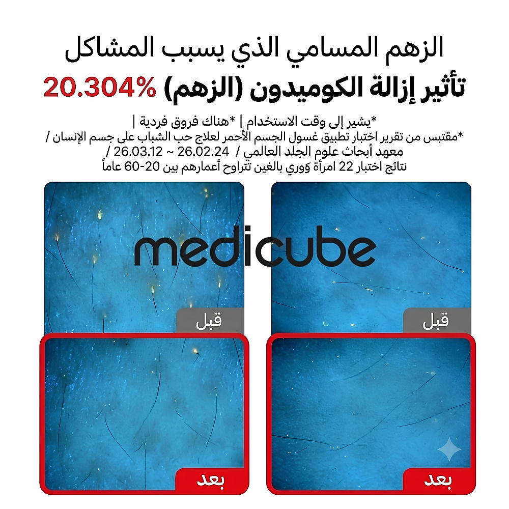 غسول الجسم "ريد" (Red) لعلاج حب الشباب 2.0 - 400 مل (إصدار مُجدَّد)