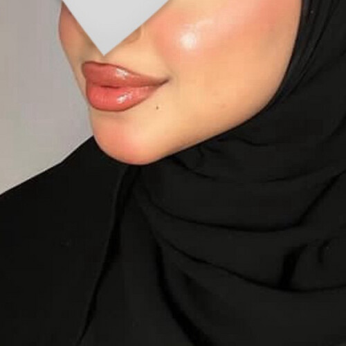 قلوس سترايك
