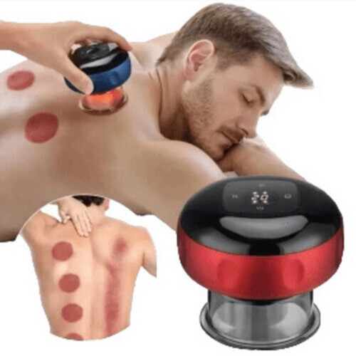 Smart cupping massage device
