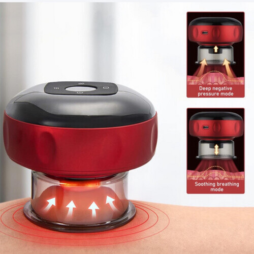 Smart cupping massage device