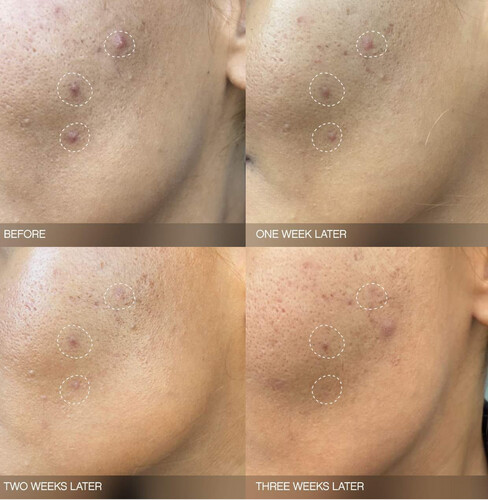 Full size Faded Brightening Serum for Dark Spots and Discoloration (UNSCENTED)