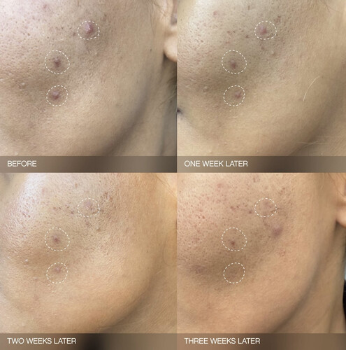 Full size Faded Brightening Serum for Dark Spots and Discoloration (UNSCENTED)