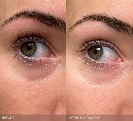 Faded Brightening Bundle for Discoloration on Face & Body (UNSCENTED)