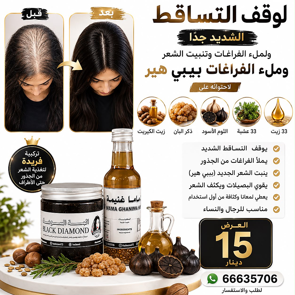 Offer for hairloss mama ghanima and black diamond